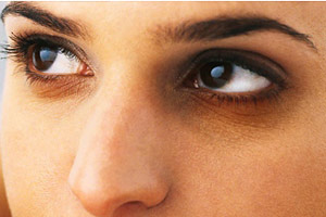 ویتامین های مناسب برای برطرف کردن سیاهی دور چشم