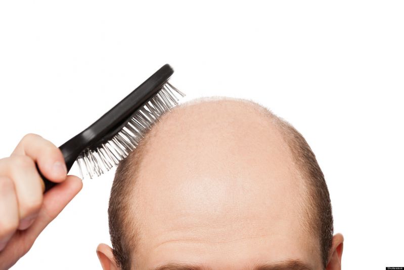 عوامل اصلی کچلی مو و راه‌های درمان آن