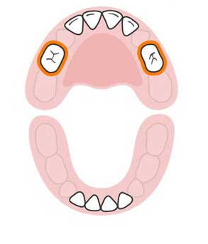 با ترتیب رشد دندان های کودکتان آشنا شوید
