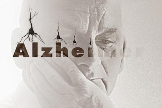 ترفندهای  عملی برای پیشگیری از آلزایمر