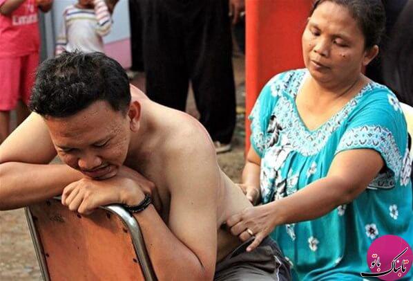سکه درمانی دردناک در اندونزی
