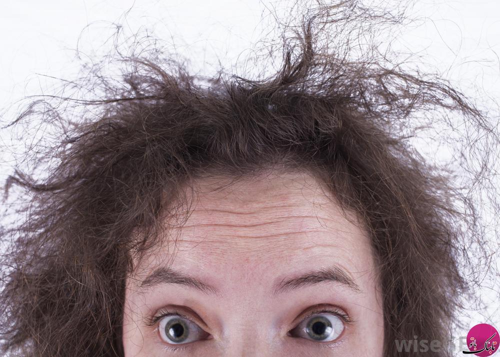 کشف بیماری های پنهان از موهای سر