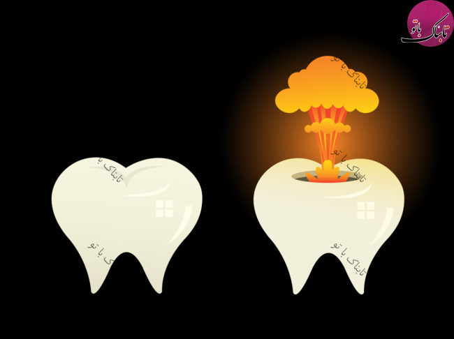 آشنایی با پدیده عجيب «انفجار دندان»