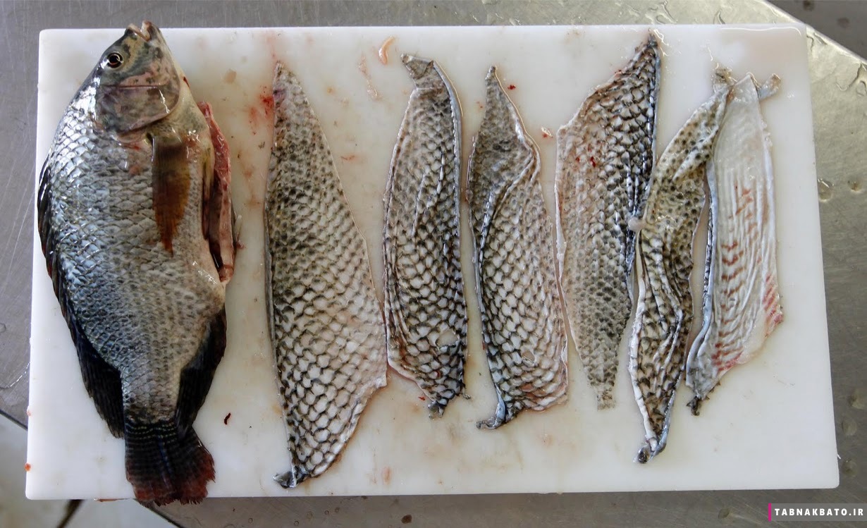 درمان نوین سوختگی با پوست ماهی در برزیل