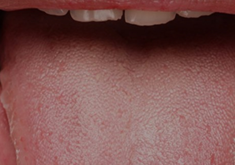 علت التیام سریع زخم های دهان