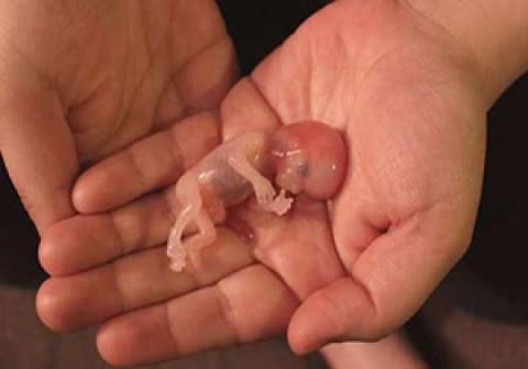 جنین انسان چند دقیقه بعد از سقط شدن