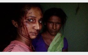 سلفی عجیب زن هندی پس از درگیری با ببر وحشی+عکس