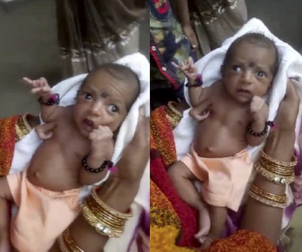 تولد نوزادی با ۳ دست در هندوستان +عکس