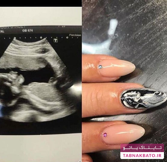 چاپ عکس جنین بر روی ناخن، ایده‌ای جالب و متفاوت