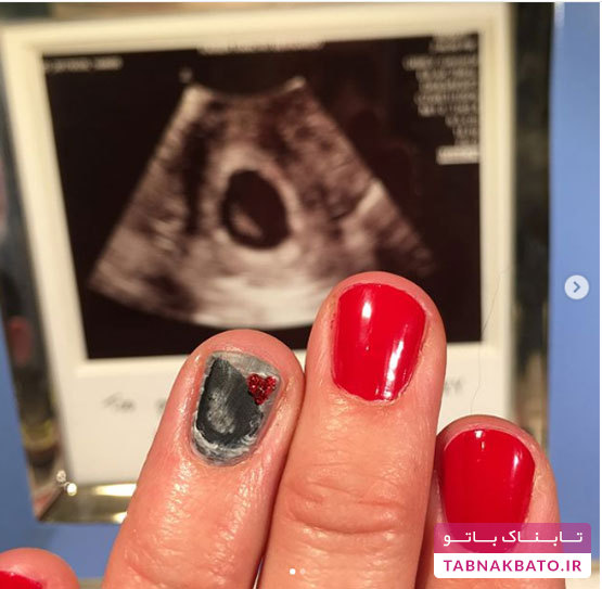 چاپ عکس جنین بر روی ناخن، ایده‌ای جالب و متفاوت