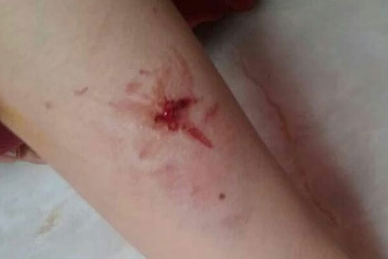 حمله سگ‌های ولگرد به یک خانم در لواسان+عکس