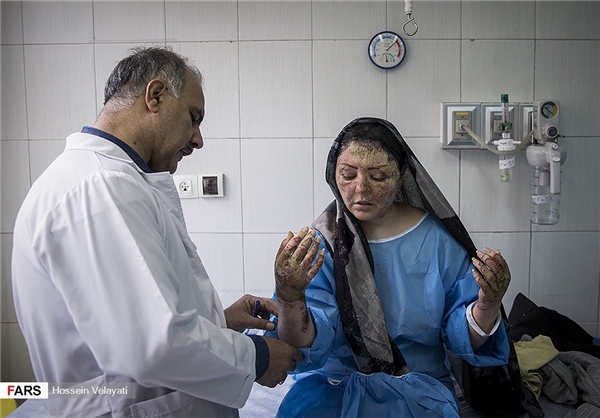 آخرین وضعیت درمانی قربانی اسید پاشی تبریز +تصاویر