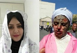 توضیح پزشکی قانونی درباره پرونده اسیدپاشی تبریز