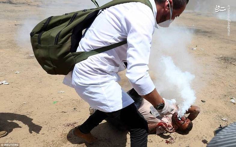 اصابت گاز اشک آور به دهان یک جوان فلسطینی +عکس