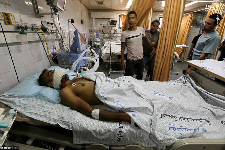 اصابت گاز اشک آور به دهان یک جوان فلسطینی +عکس