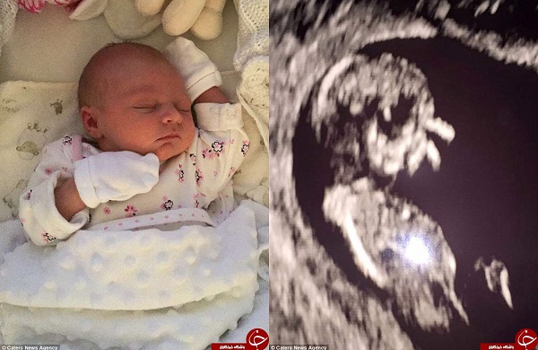 سونوگرافی عجیب یک نوزاد مادرش را نگران کرد +عکس