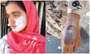 دستگیری نامادری سنگدل در پی آزار دختر ۱۳ ساله +عکس