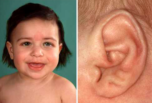 آیا می‌دانستید شکل گوش شما اسرار سلامت کل بدن شما را فاش می‌کند؟