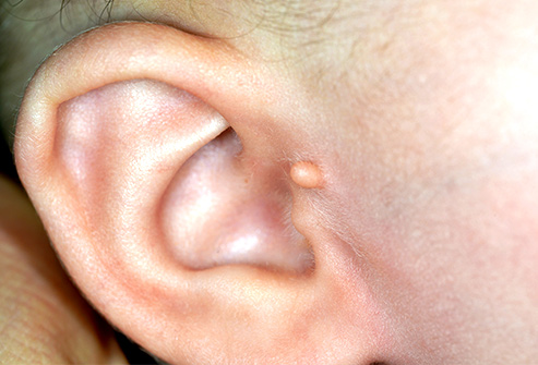 آیا می‌دانستید شکل گوش شما اسرار سلامت کل بدن شما را فاش می‌کند؟