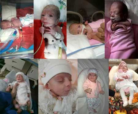 ماجرای تولد نوزاد نیم کیلویی در قم+عکس