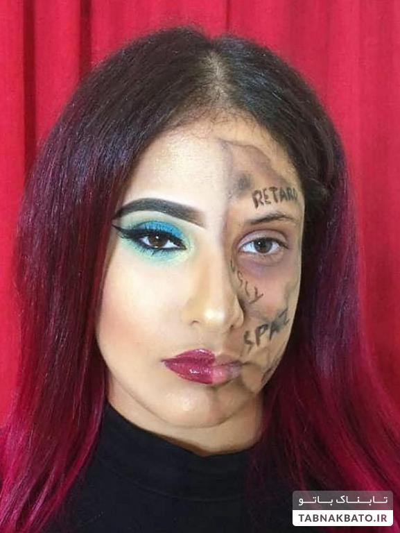 دختر معلولی که کلمات آزار دهنده را روی صورتش نوشت