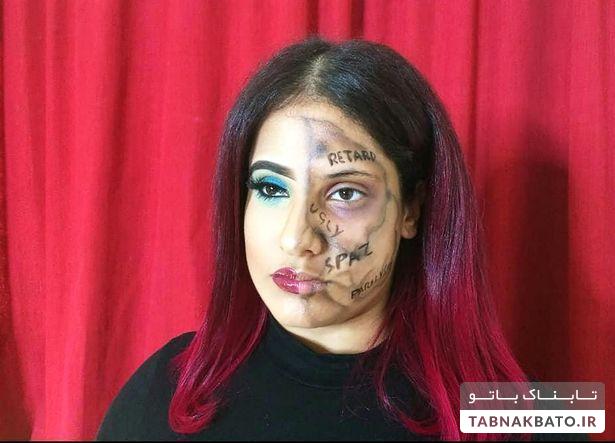 دختر معلولی که کلمات آزار دهنده را روی صورتش نوشت