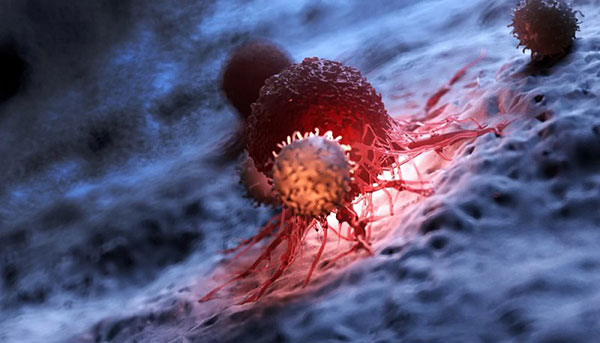 انواع سرطان بر اساس سلول‌های مهاجم