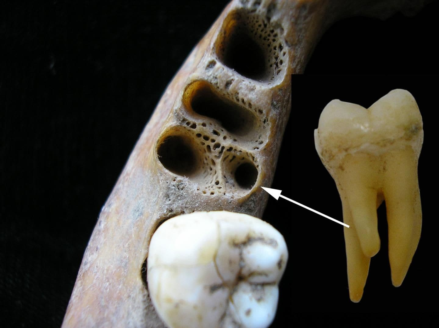 دندان عجیب و قدیمی که سه ریشه دارد+عکس
