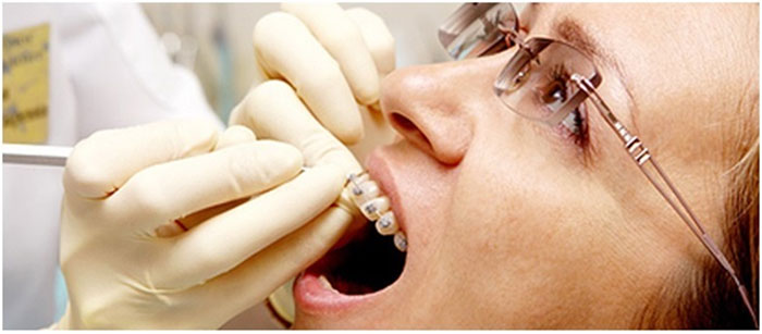 چگونه می توانیم یک دندانپزشک خوب و با قیمت مناسب پیدا کنیم؟