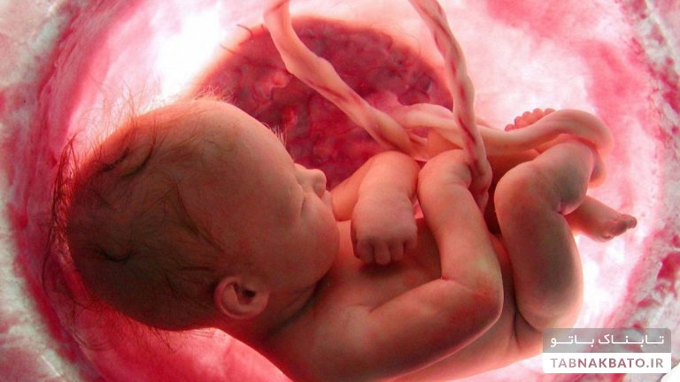 جسد هزاران جنین در خانه پزشک آمریکایی