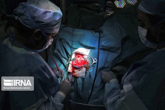 نخستین عمل جراحی بدون بیهوشی مغز در مشهد+عکس