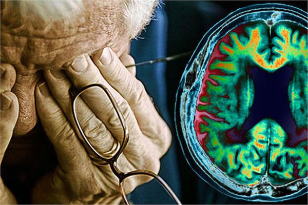 آلزایمر؛ نشانه‌ها، درمان و راه‌های پیشگیری