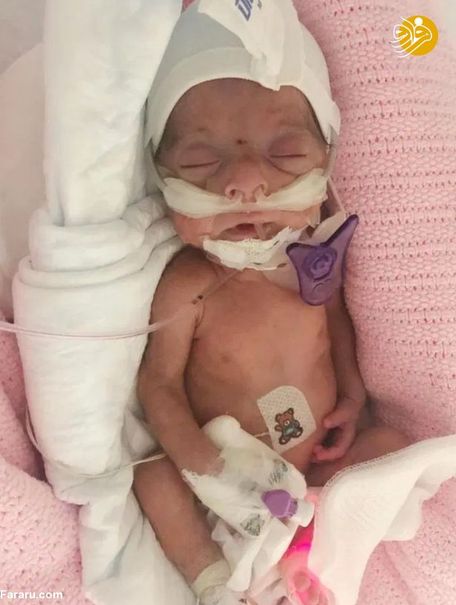 بیمارستان سلطنتی دوبی نوزاد انگلیسی را گروگان گرفت +تصاویر