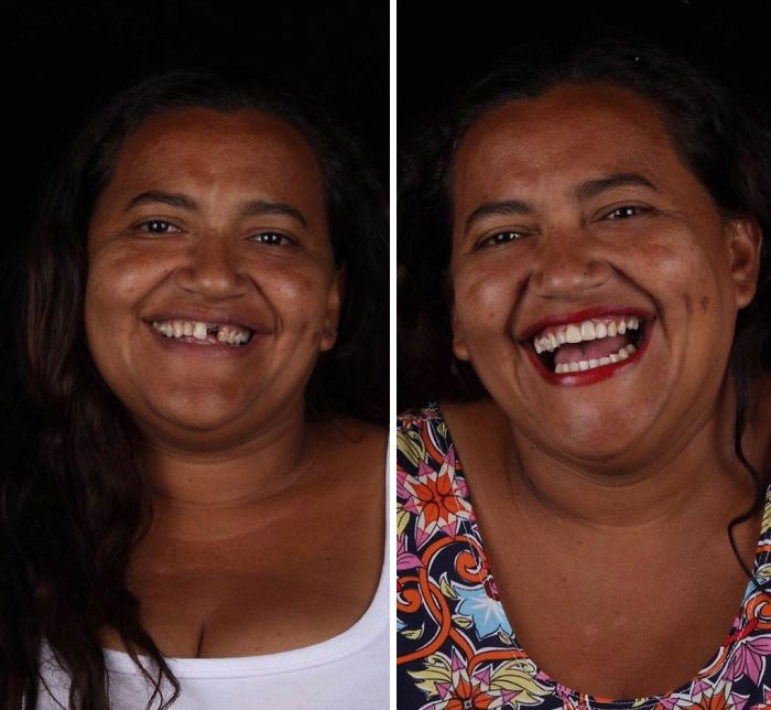 یک دندانپزشک برزیلی که با تاسیس یک NGO، لبخند فقیرترین آدم‌های زمین را دوباره زیبا می‌کند!
