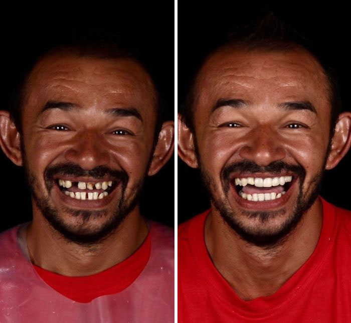 یک دندانپزشک برزیلی که با تاسیس یک NGO، لبخند فقیرترین آدم‌های زمین را دوباره زیبا می‌کند!