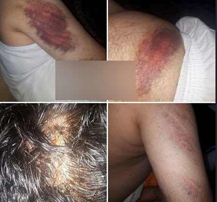 حمله خانواده دانش آموز شلاق خورده به معلم +تصاویر