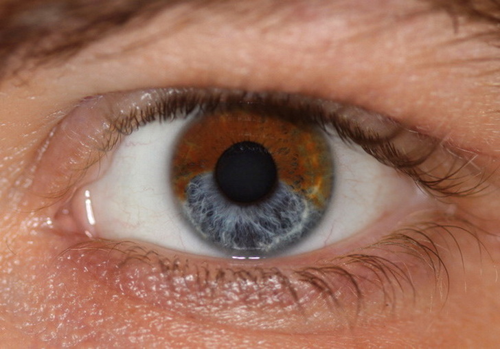 ۷ چیزی که می توانند رنگ چشم ها را تغییر دهند