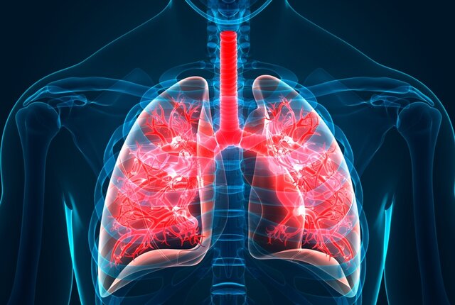 آمبولی ریه چیست؟ علایم، تشخیص و درمان آن به چه صورت است؟