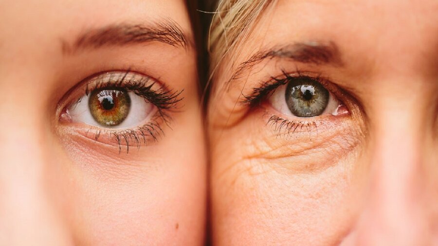 نکته های اساسی برای جلوگیری از پیری زودرس پوست دور چشم