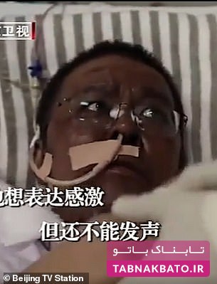 سرانجام پزشکان چینی که بر اثر کرونا سیاه شده بودند