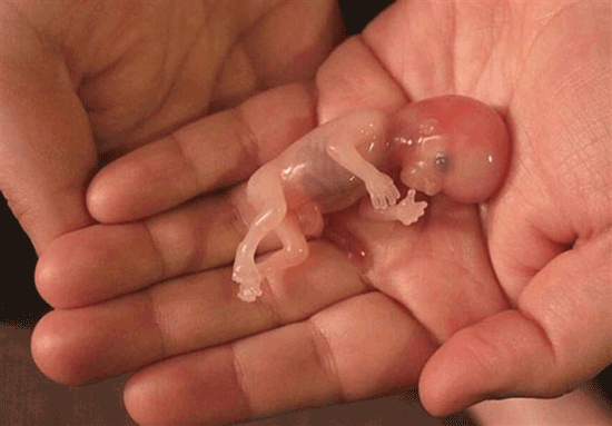 از مراکز «سقط جنین زیرپله‌ای» چه می‌دانید؟