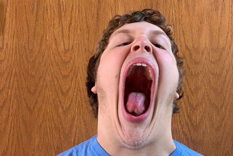 ثبت رکورد جهانی برای گشاد‌ترین دهان جهان +عکس