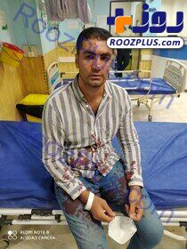 حمله وحشتناک سارقان مسلح به بوکسور ایرانی+عکس