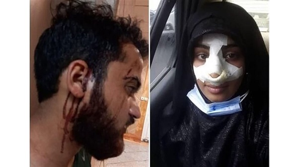 کتک‌زدن طلبه جوان و همسرش در مهرشهر