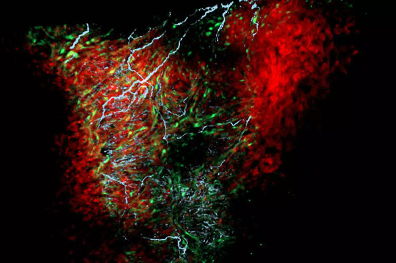 نکسوس گلیا: سلول‌های جدید کشف شده در قلب که ضربان و ریتم قلب را تنظیم می‌کنند