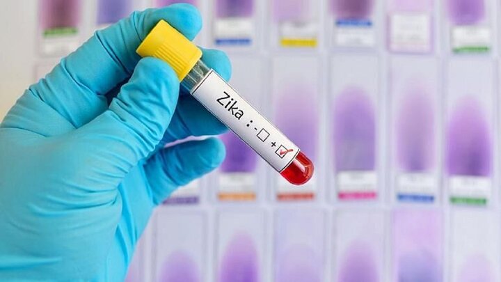 هشدار دانشمندان: مراقب ویروس زیکا باشید