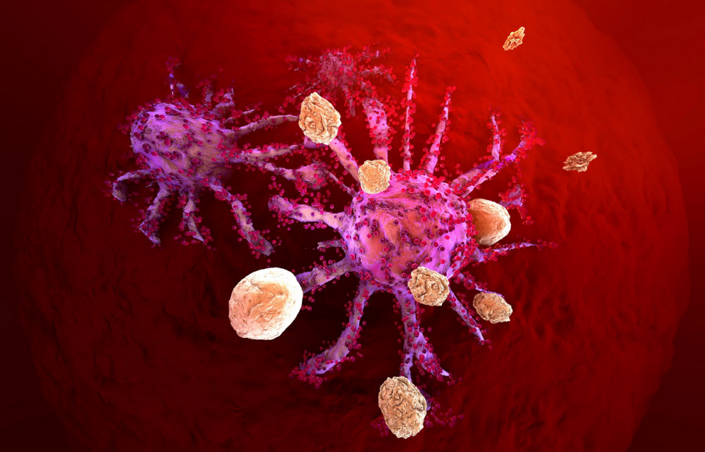 حمله دوگانه سلول‌ها؛ امیدی برای از بین بردن سرطان متاستاتیک پستان