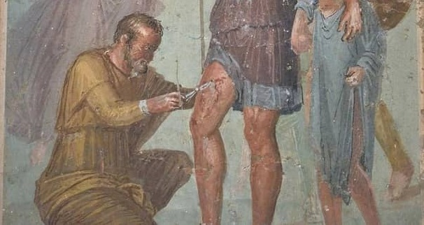 حقایق ترسناک و عجیب از پزشکان روم باستان