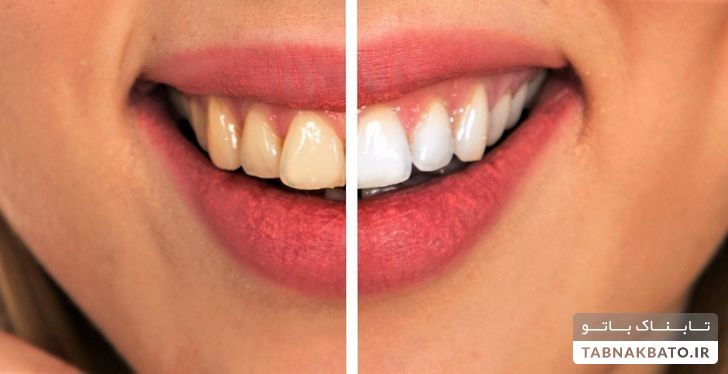 8 راهکار ساده برای اینکه پولی برای دندانپزشکی خرج نکنید!