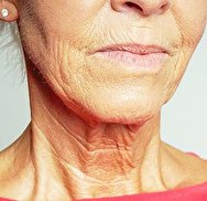 ۳ راهکار برای مقابله با چروک‌ پوست گردن
